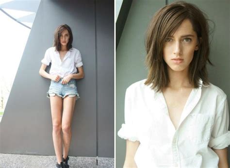 teddy quinlivan before and after